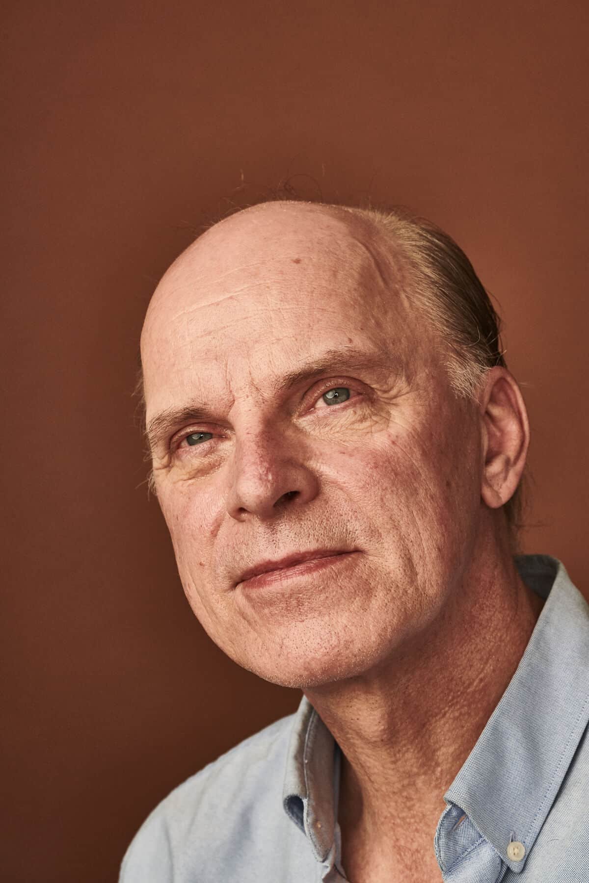 Patient behandlet med Mohs kirurgi på næsen