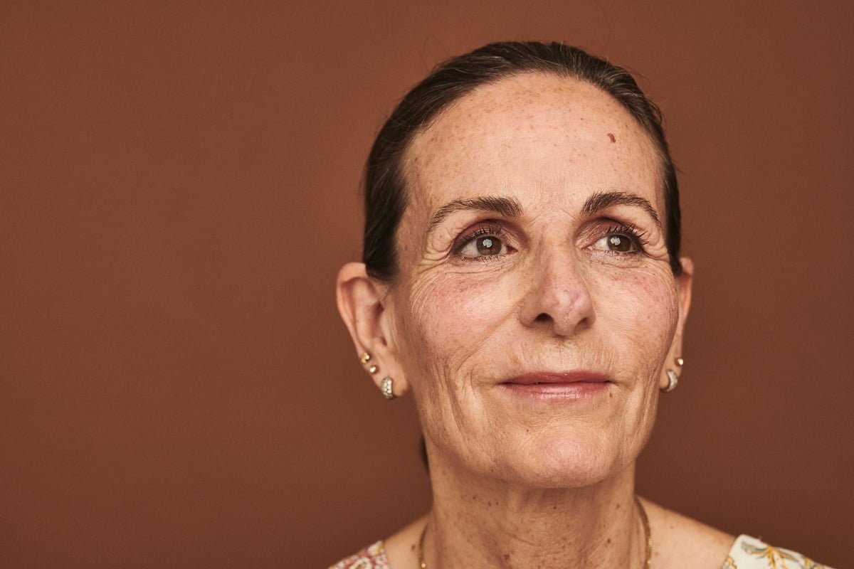 Patient behandlet med Mohs kirurgi på næsen